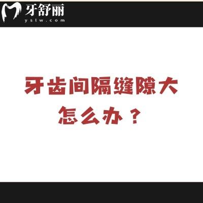 牙齿间隔缝隙大怎么办?常见五种原因+解决方法奉上