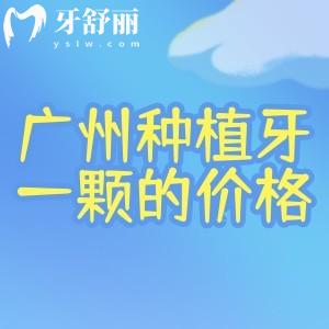 广州种植牙一颗的价格2k-1.2w不等!详细广州种牙收费标准及性价比高医院名单分享
