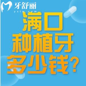满口种植牙大概多少钱?查询老人全口假牙价目表可知3-20w不等可选活动假牙