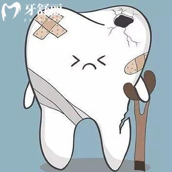 牙齿根管治疗是怎么回事？下面为大家解析下
