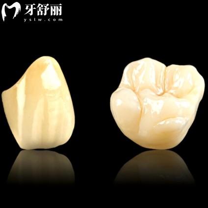 登腾全瓷牙和爱尔创全瓷牙的区别，到底哪个才是你的“牙”选？