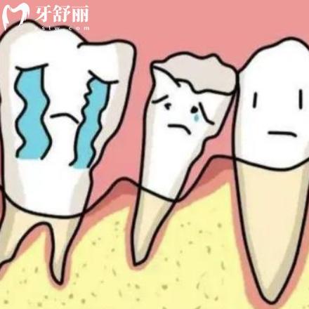 牙龈萎缩牙根露出怎样治疗？有困扰的不放来了解下