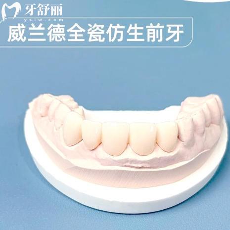 威兰德全瓷牙色号怎么选？几步总结选色的黄金法则