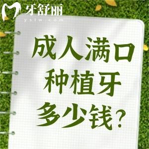 成人满口种植牙多少钱?满口种植牙价格收费标准约4-15万元差距较大