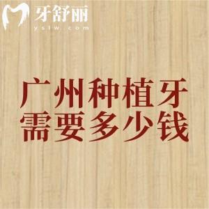广州补贴后种植牙需要多少钱？2025年广州种植牙（单颗/半口/全口）价格已下调
