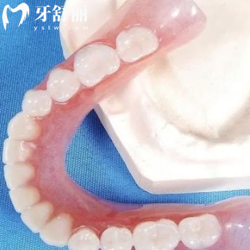 德国无挂钩镶牙是什么意思?分析优缺点原理看舒适度是真的好靠谱价格合理