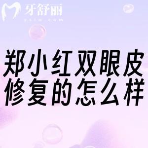 郑小红双眼皮修复的怎么样?高难度修复例子多死磕技术大家满意度就是高