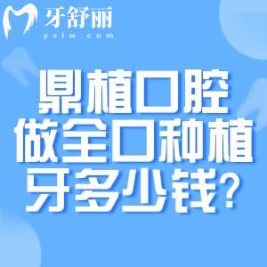 鼎植口腔做全口种植牙多少钱?国产/进口/即刻/穿颧等种牙技术价格一览
