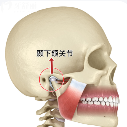 颞颌关节紊乱是什么原因造成的？可能从未注意的问题是罪魁祸首
