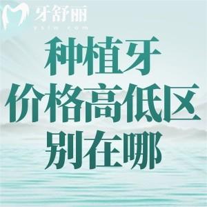 种植牙价格高低区别在哪里?品牌/材质/型号是一方面,医生技术/手术方式也相关