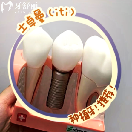 瑞士ITI种植牙能用多久？揭秘影响寿命的五大关键因素