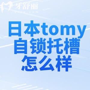 十大自锁托槽品牌的日本tomy怎么样?详细介绍拓美矫正器型号/优势/价格