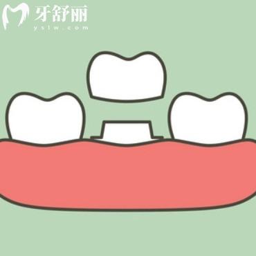 汇总南通装假牙比较好的10家医院:这几家牙科口腔医生装全口假牙好价格便宜