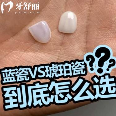 蓝瓷琥珀瓷灵犀瓷有什么区别？一篇看懂三种高端瓷牙特点