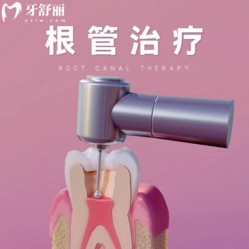 25年上海根管治疗收费标准更新,看牙疼500元起还有其他热门项目价格