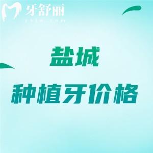 盐城种植牙多少钱一颗2026价格表更新,单颗(国产1880/进口2280)+半/全口植体2w元起