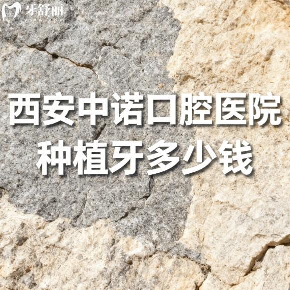 西安中诺口腔医院种植牙多少钱?【2026价格攻略】美格真3980+皓圣4600+及医生推荐