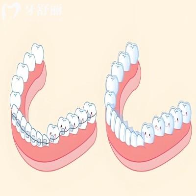 天津吸附性义齿哪里做得好?老年人装全口假牙这10家便宜又靠谱