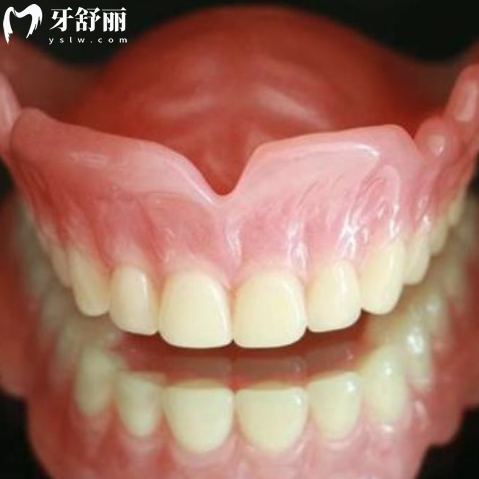 解析吸附性义齿的优缺点,和普通义齿有啥差别及价格