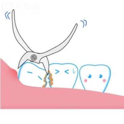 拔牙后不种牙让它空着行不行？有哪些注意事项