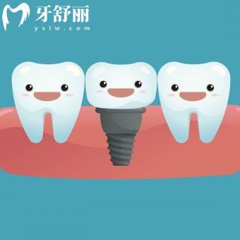 iti和nobel种植体哪个好?从区别和价格了解下