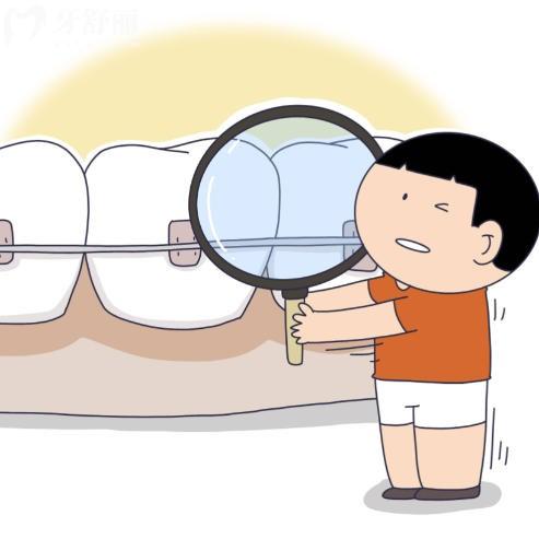 儿童牙齿矫正指南：家长必知的时机、方法与注意事项