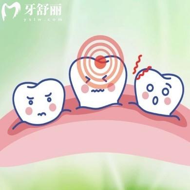 洗牙喷砂和不喷砂有区别？一文读懂口腔清洁的奥妙