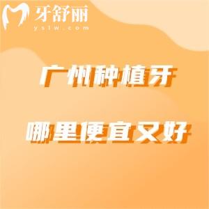 广州种植牙哪里便宜又好？分享广州牙科医院排行榜前十名技术好价格实惠