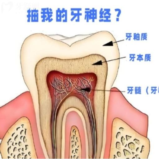 根管治疗一般要做几次？收几次的钱？分情况讲清楚
