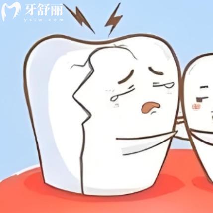 已经隐裂的牙齿能自愈吗？错过治疗当心牙齿报废！