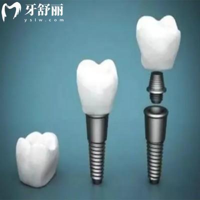 当地患者分享保定便宜又好的牙科排名,上榜的都是保定正规好牙科